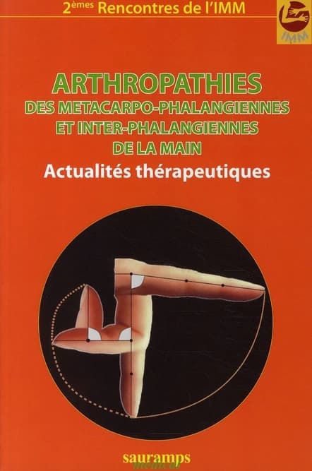 Arthropathies des MCP [métacarpo-phalangiennes] et IP [inter-phalangiennes] de la main : [actualités thérapeutiques]
