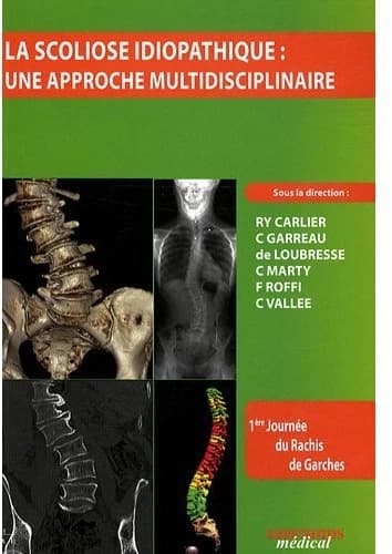 La scoliose idiopathique : une approche multidisciplinaire
