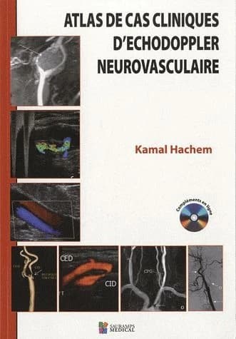 Atlas de cas cliniques d'échodoppler neurovasculaire