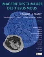 Imagerie des tumeurs des tissus mous
