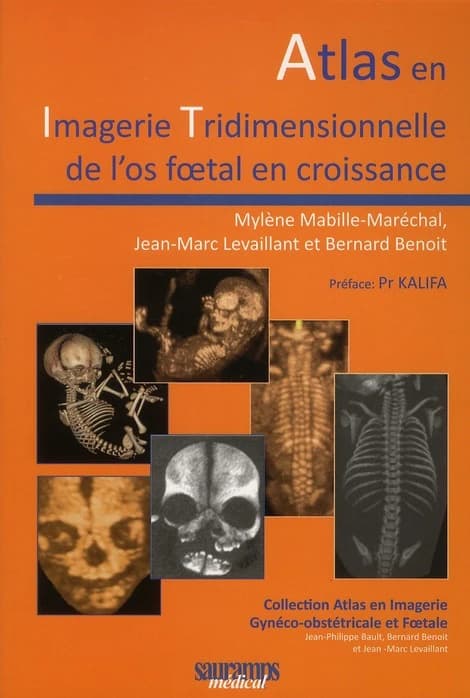 Atlas en imagerie tridimensionnelle de l'os foetal en croissance