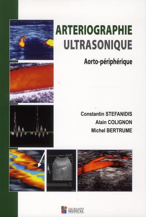 Artériographie ultrasonique : aorto-périphérique