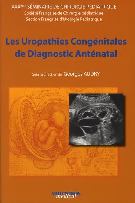 Les uropathies congénitales de diagnostic anténatal