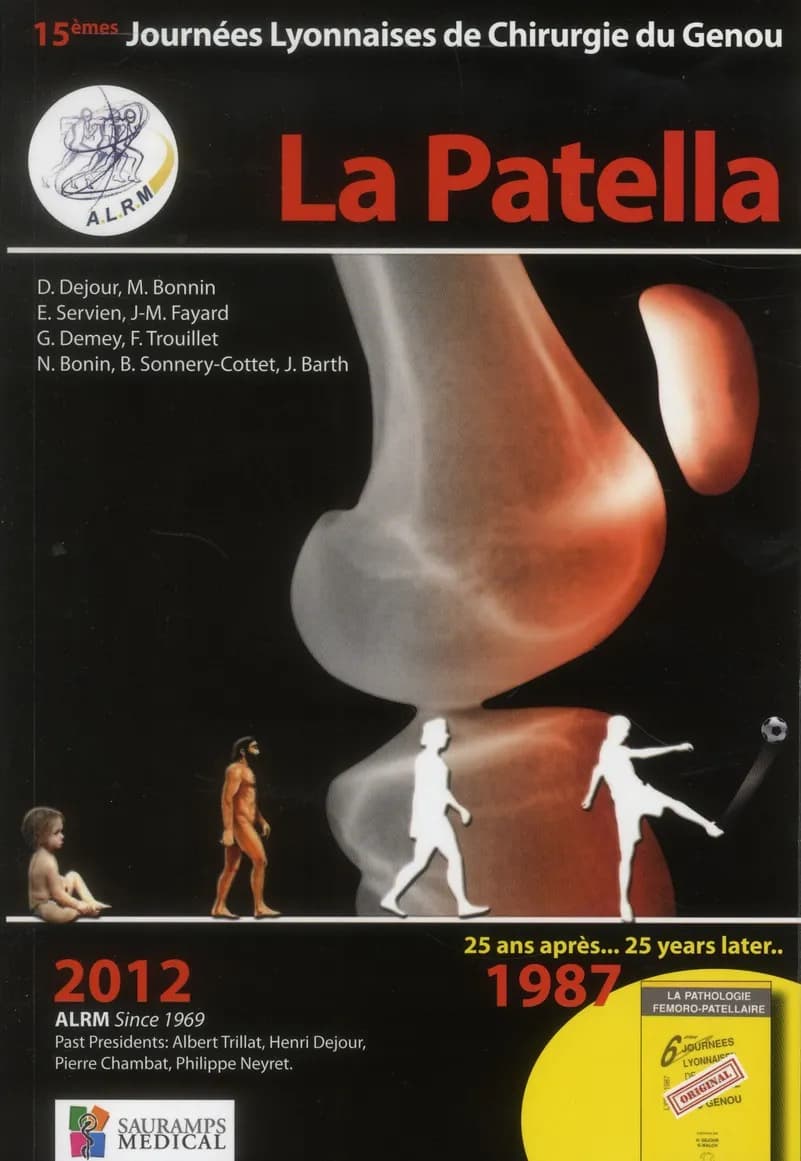 La patella