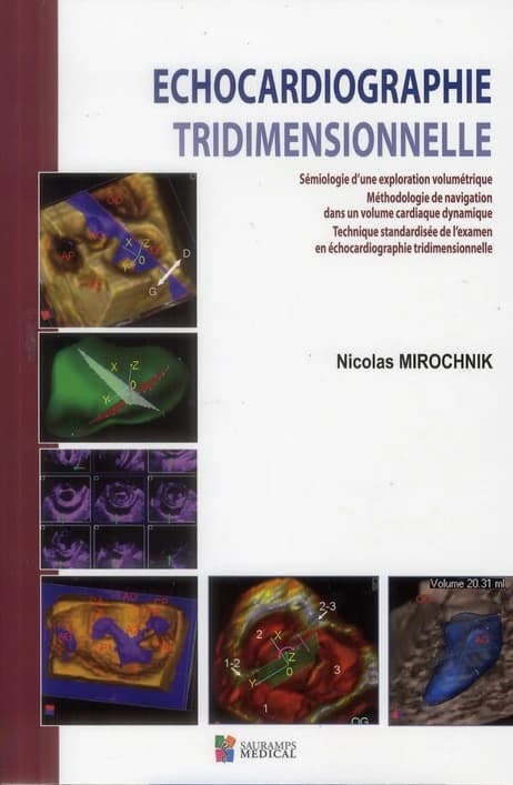 Échocardiographie tridimensionnelle : sémiologie d'une exploration volumétrique : méthodologie de navigation dans un volume cardiaque dynamique : technique standardisé de l'examen en échocardiographie tridimensionnelle