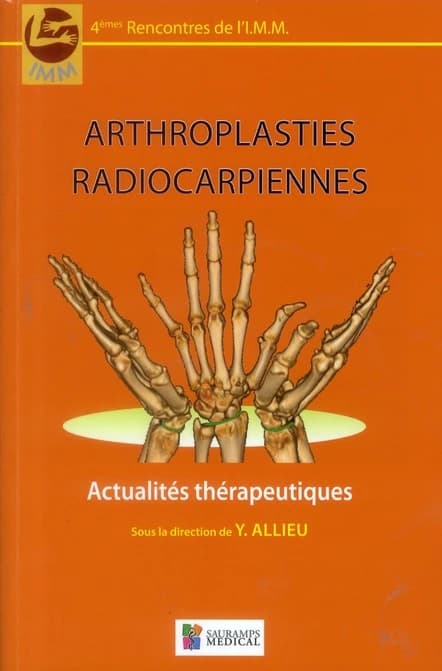 Arthroplasties radiocarpiennes : [actualités thérapeutiques]