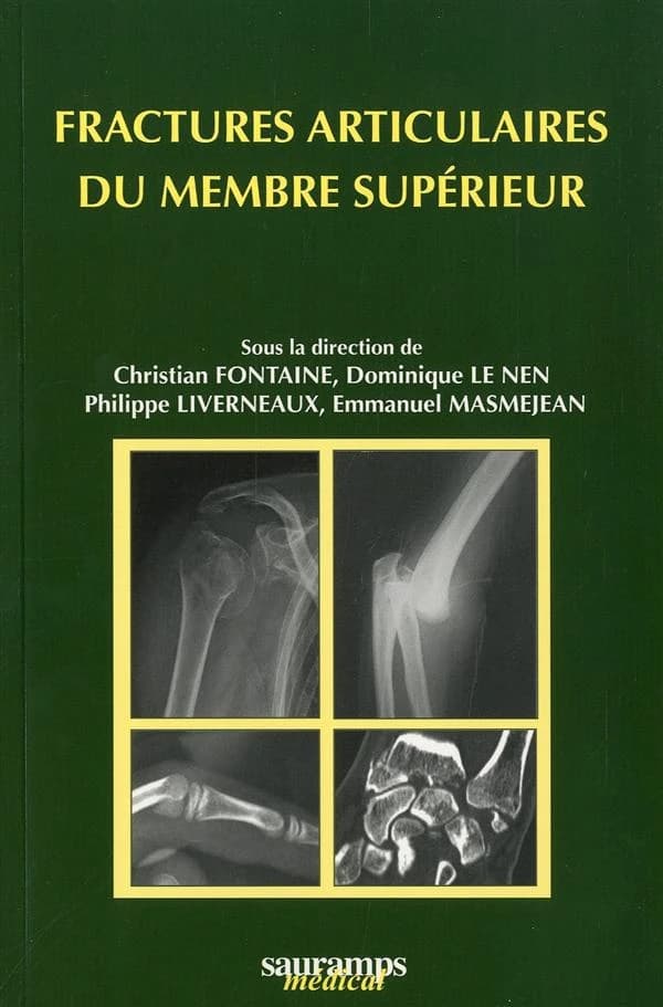 Fractures articulaires du membre supérieur