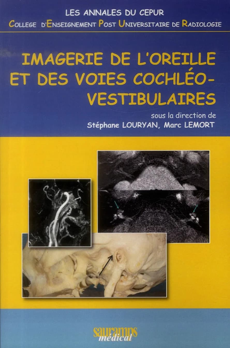 Imagerie de l'oreille et des voies cochléo-vestibulaires