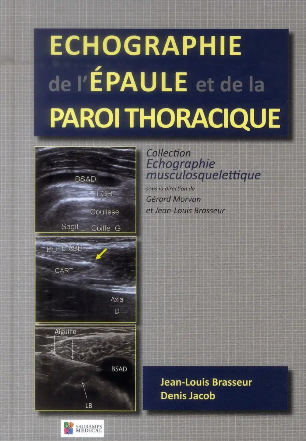 Échographie de l'épaule et de la paroi thoracique
