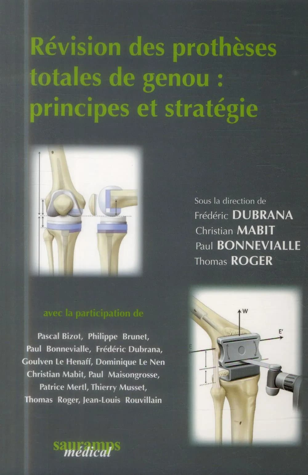 Révision des prothèses totales du genou : principes et stratégie