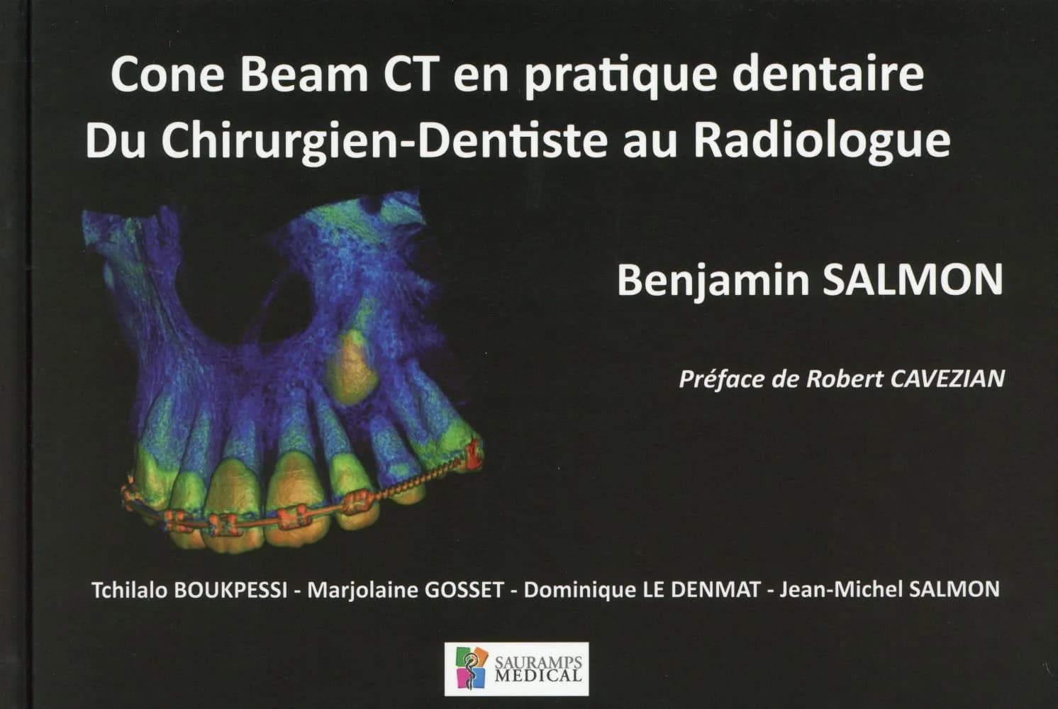 Cone Beam CT en pratique dentaire : Du chirurgien-dentiste au radiologue
