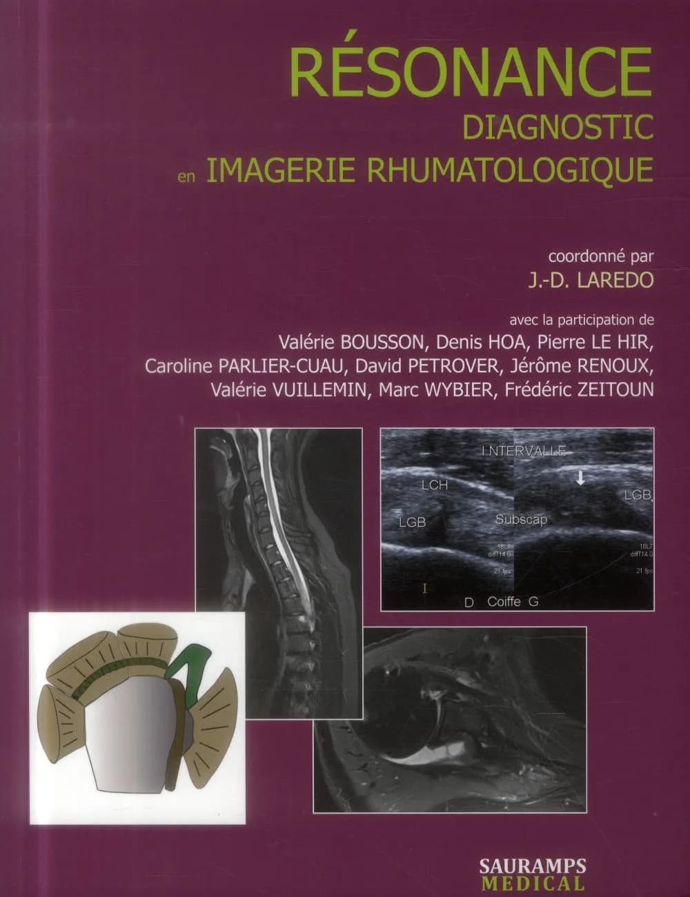 Résonance : diagnostic en imagerie rhumatologique
