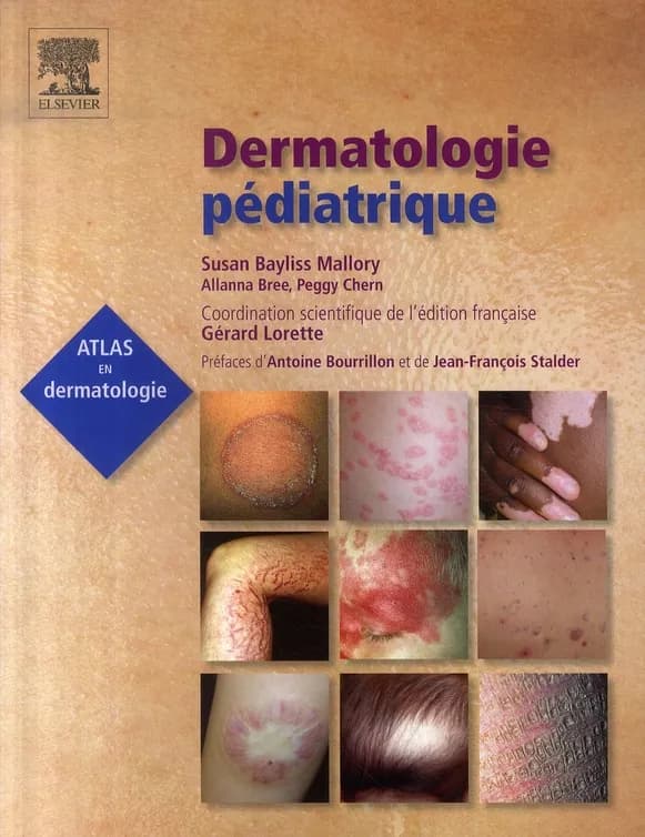 Dermatologie pédiatrique
