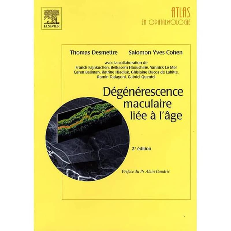 Dégénérescence maculaire liée à l'âge (2e éd.) Salomon Yves Cohen, Thomas Desmettre ; avec la collaboration de Franck Fajnkuchen, Belkacem Haouchine, Yannick Le Mer... [et al.] ; préfaces des Pr Alain Gaudric et Gabriel Coscas