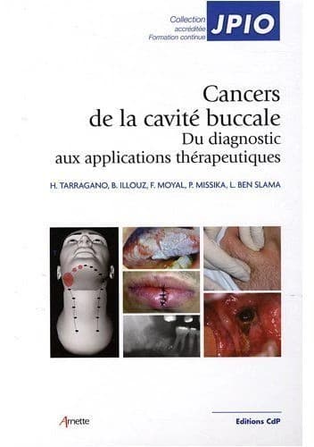 Les cancers de la cavité buccale : du diagnostic aux applications thérapeutiques