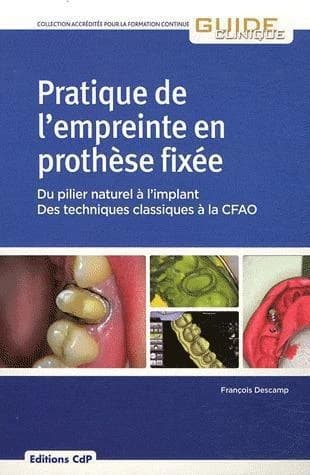 Pratique de l'empreinte en prothèse fixée : du pilier naturel à l'implant, des techniques classique à la CFAO