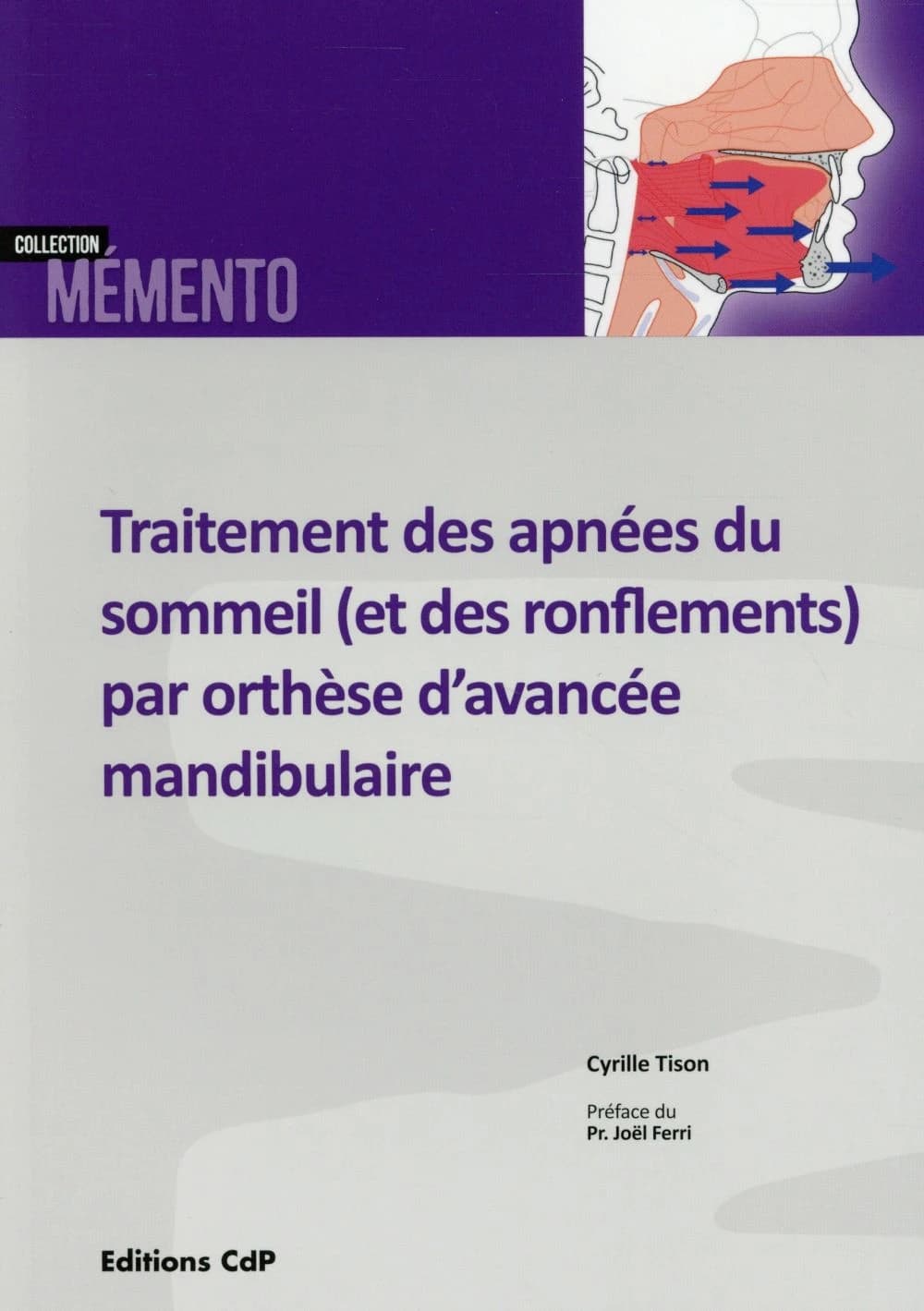 Traitement des apnées du sommeil et des ronflements par orthèse d'avancée mandibulaire : du spécialiste du sommeil au spécialiste de l'appareil manducateur