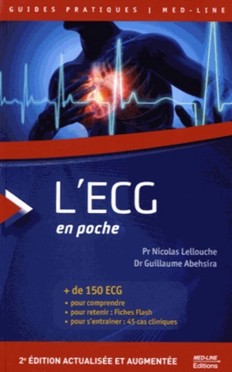 L'ECG en poche