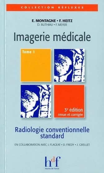 Imagerie médicale. Tome 1, Radiologie conventionnelle standard (3e éd. revue et corrigée) E. Montagne, F. Heitz, D. Buthiau... [et al.] ; en collaboration avec J. Flageat, D. Fredy et J. Grellet
