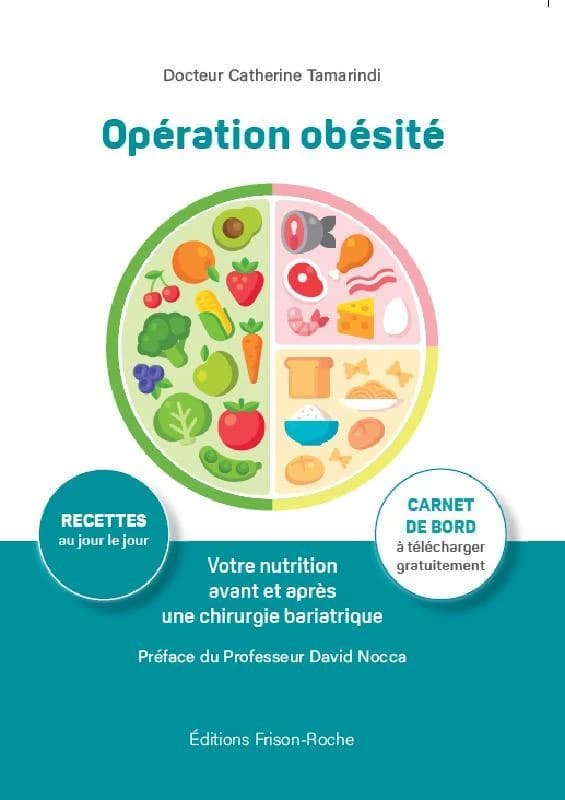 Opération obésité : votre nutrition avant et après une chirurgie bariatrique