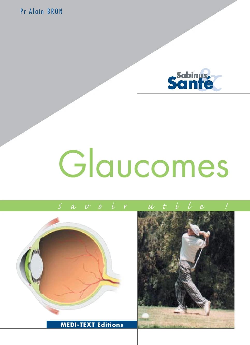 Glaucomes