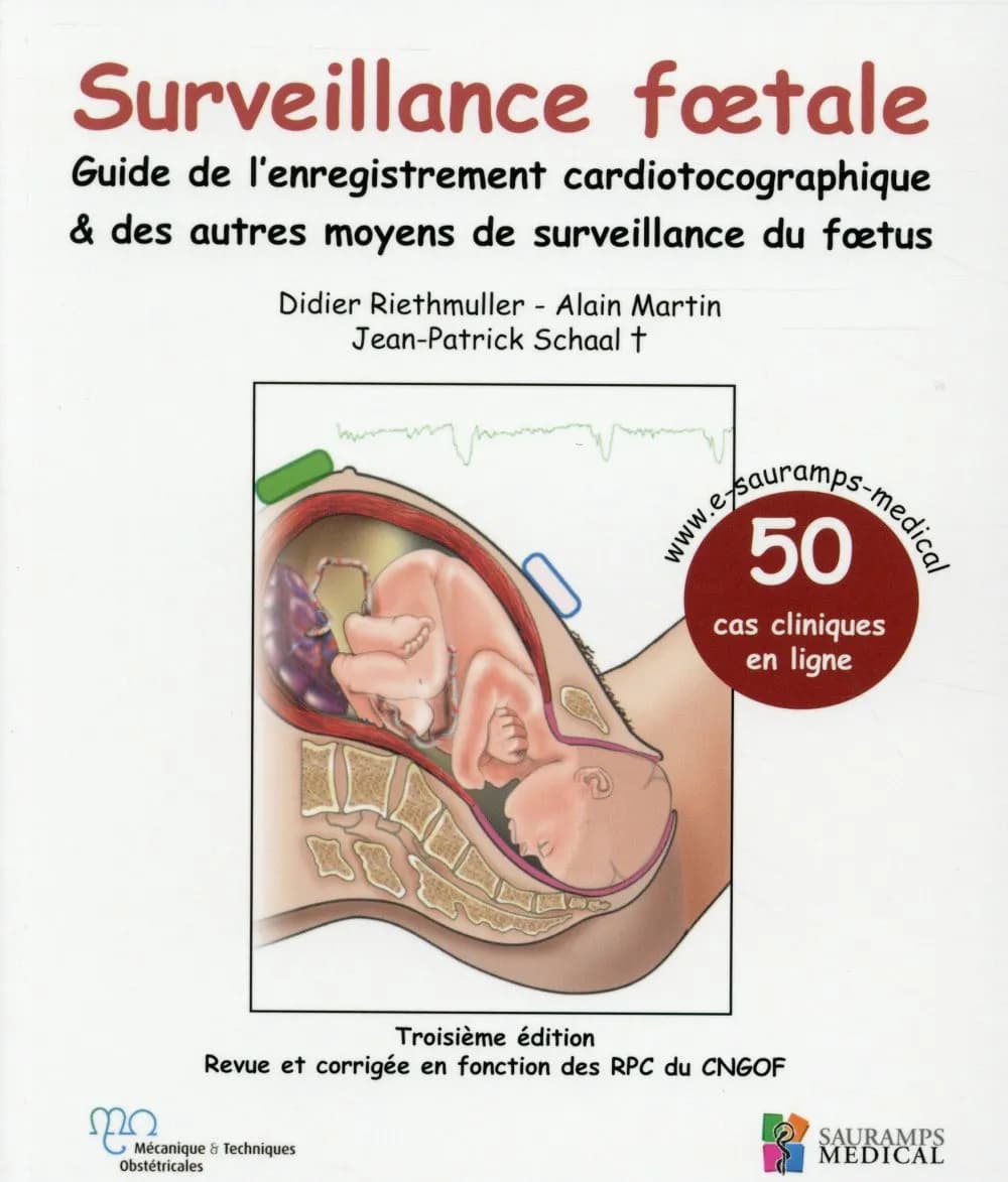 Surveillance foetale : guide de l'enregistrement cardiotocographique & des autres moyens de surveillance du foetus (3e éd. revue et corrigée) Didier Riethmuller, Alain Martin, Jean-Patrick Schaal