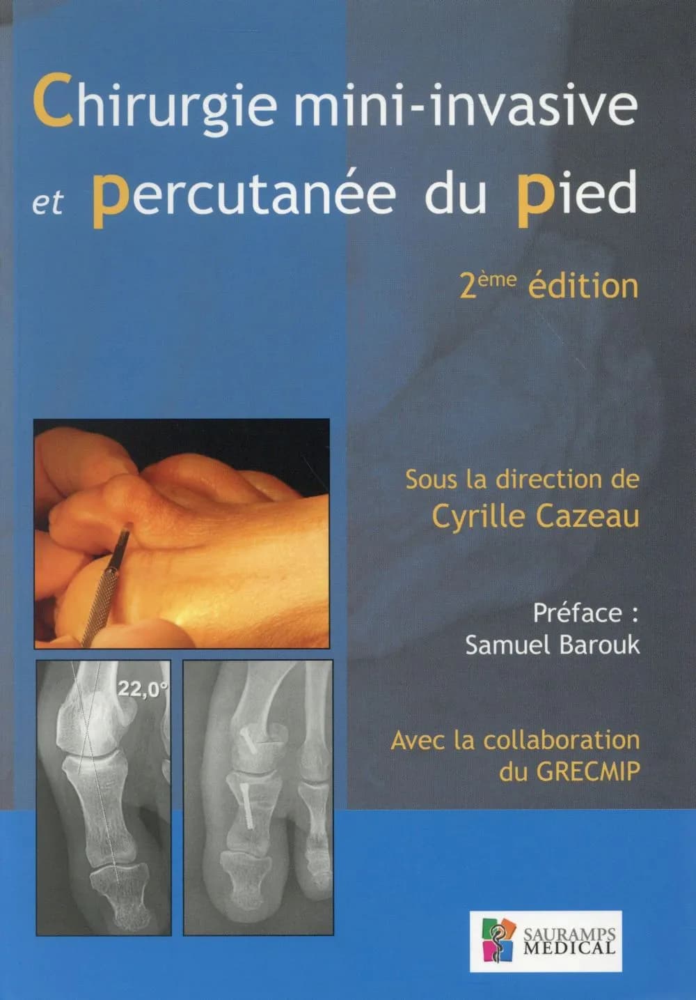 Chirurgie mini-invasive et percutanée du pied (2e éd.) sous la direction du Dr Cyrille Cazeau ; avec la collaboration du GRECMIP