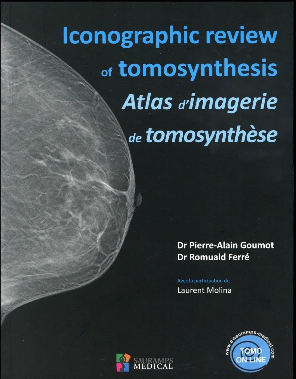 Iconographic review of tomosynthesis