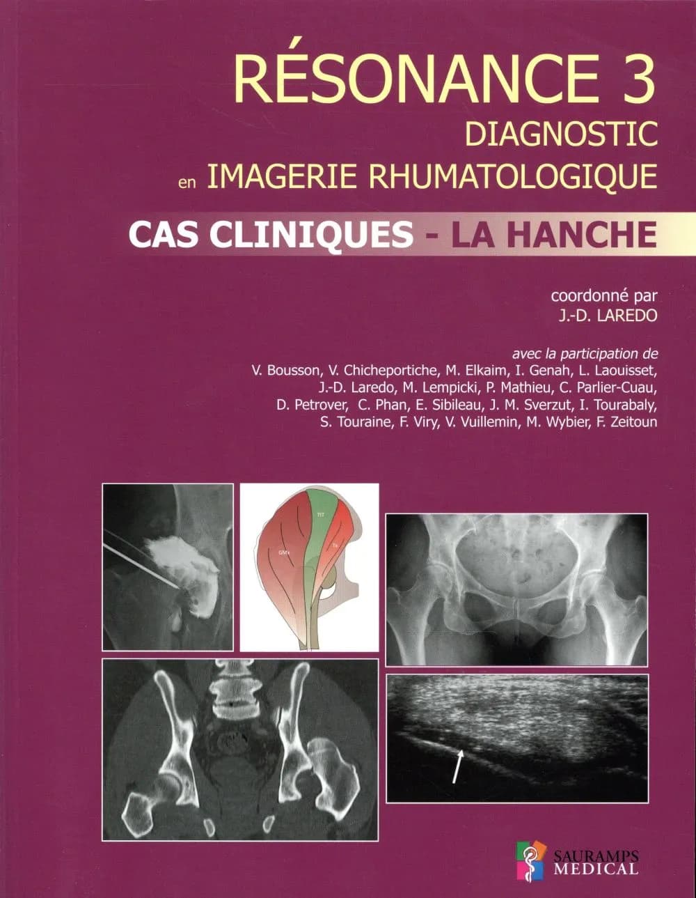 Cas cliniques, la hanche