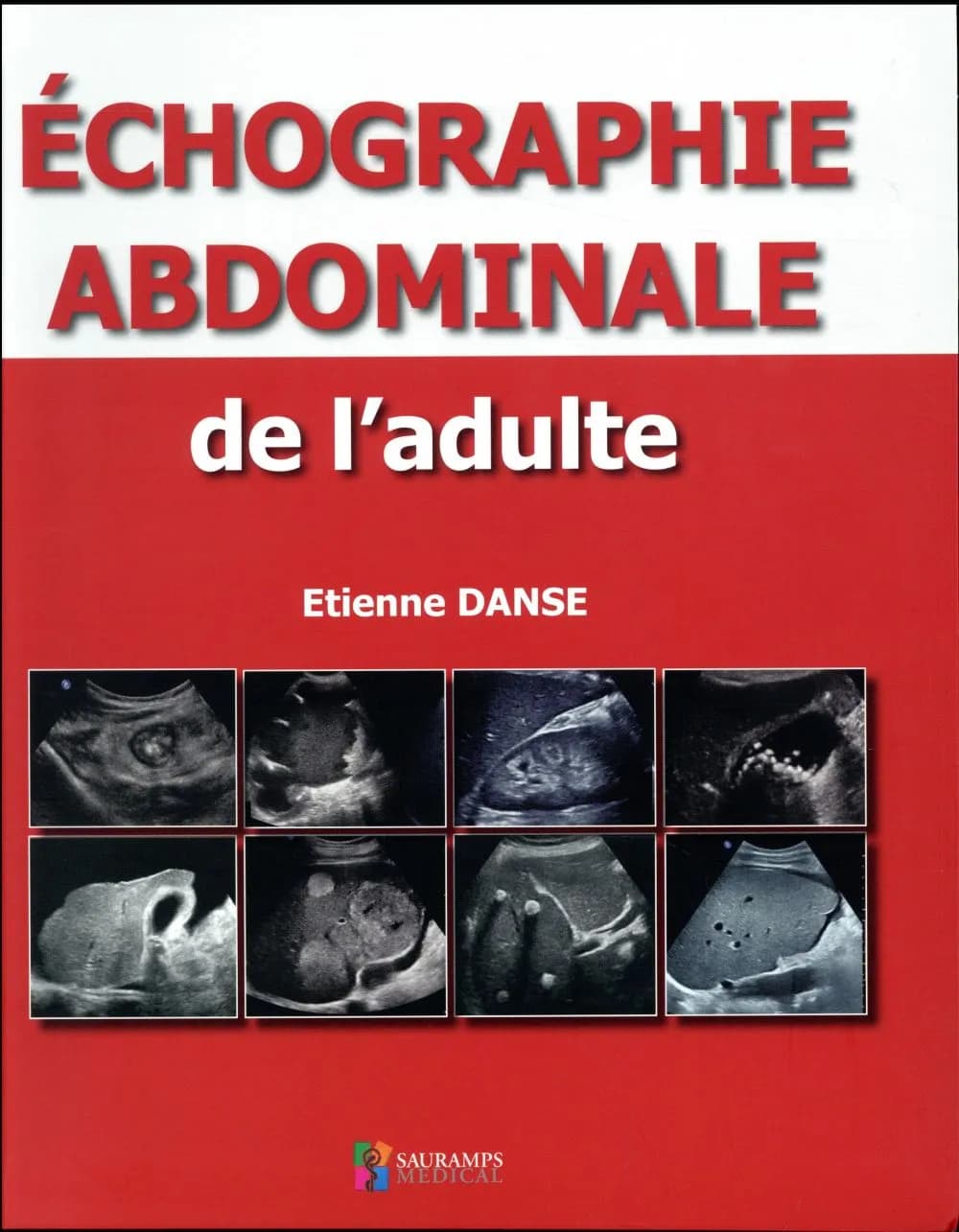 Échographie abdominale de l'adulte