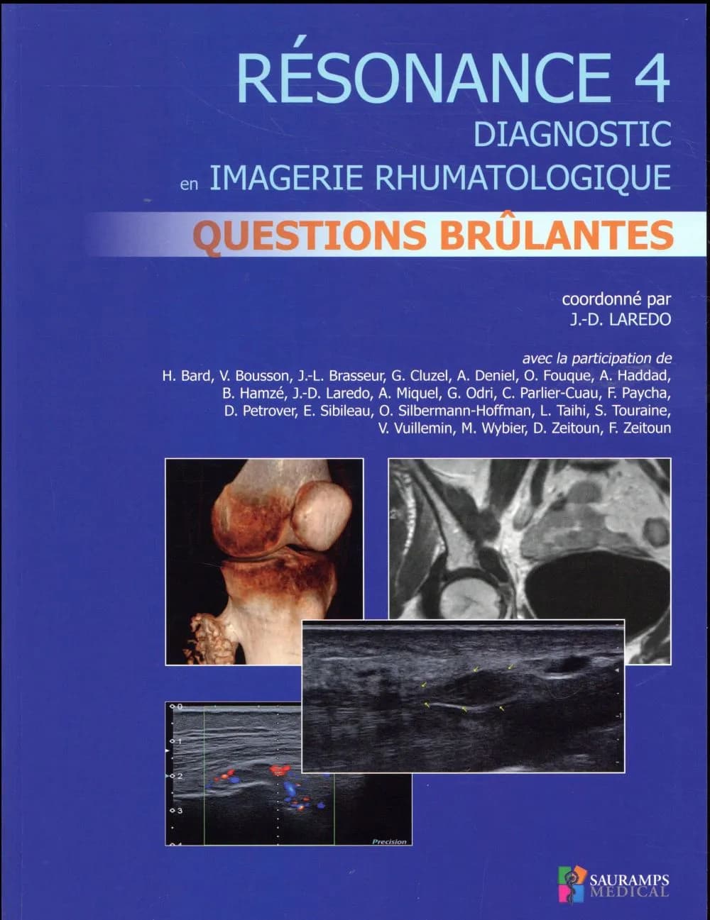 Questions brûlantes en imagerie ostéo-articulaire : cas cliniques