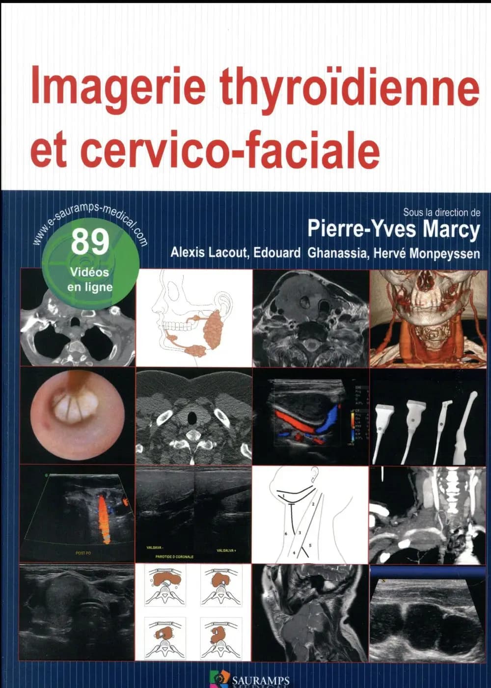 Imagerie thyroïdienne et cervico-faciale ([Nouvelle éd.])