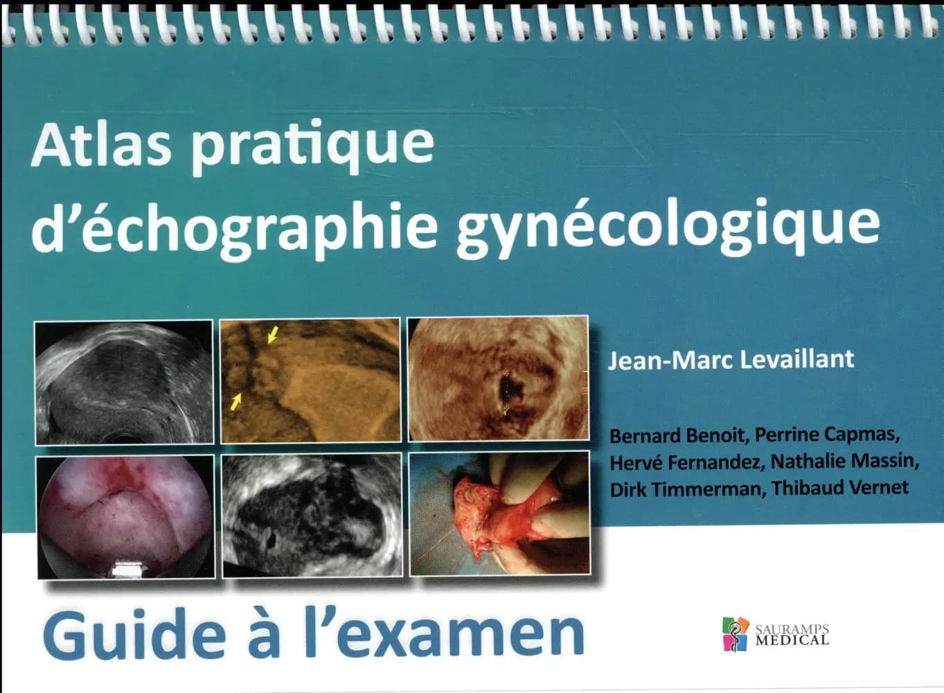 Guide à l'examen : atlas pratique d'échographie gynécologique