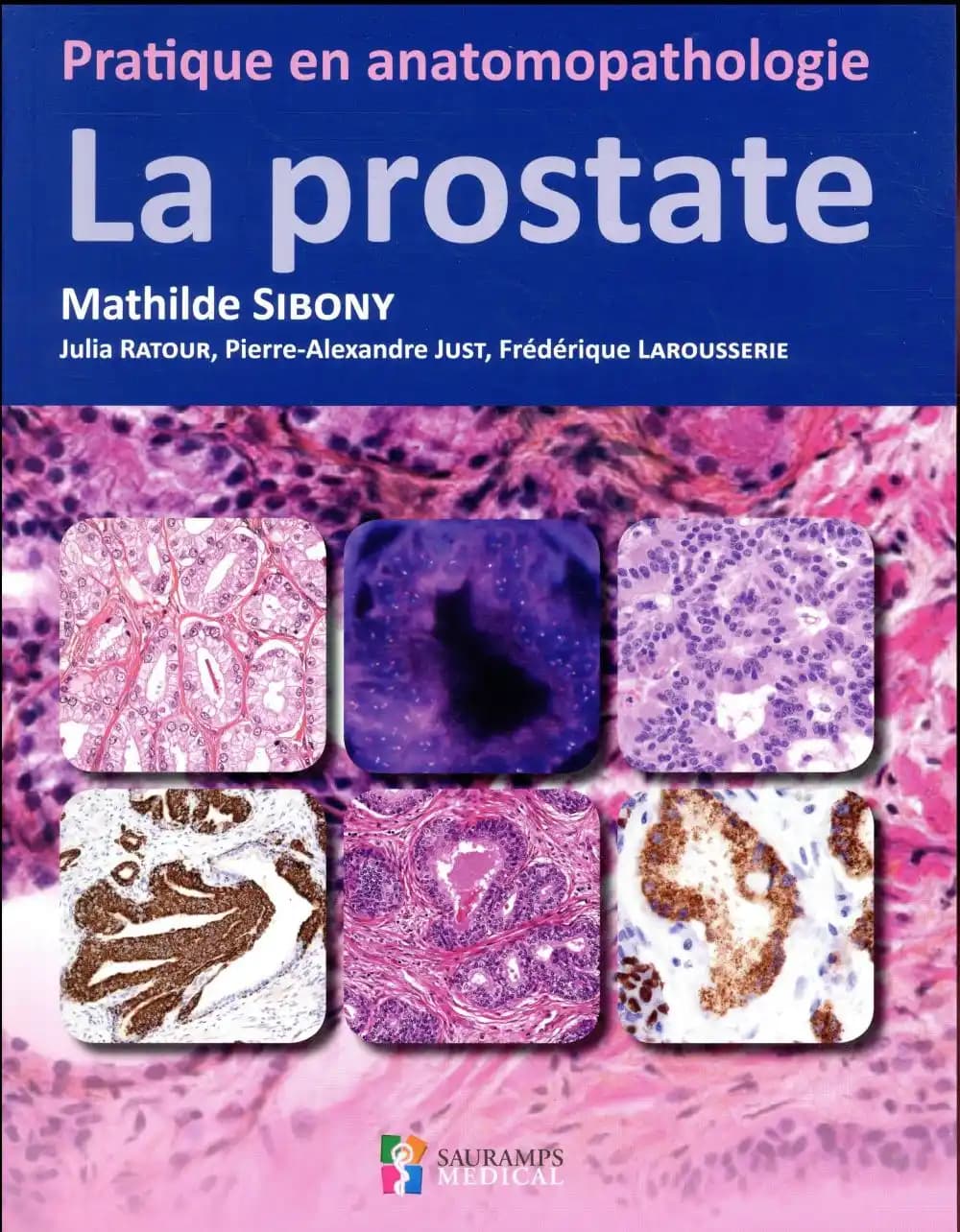 La prostate