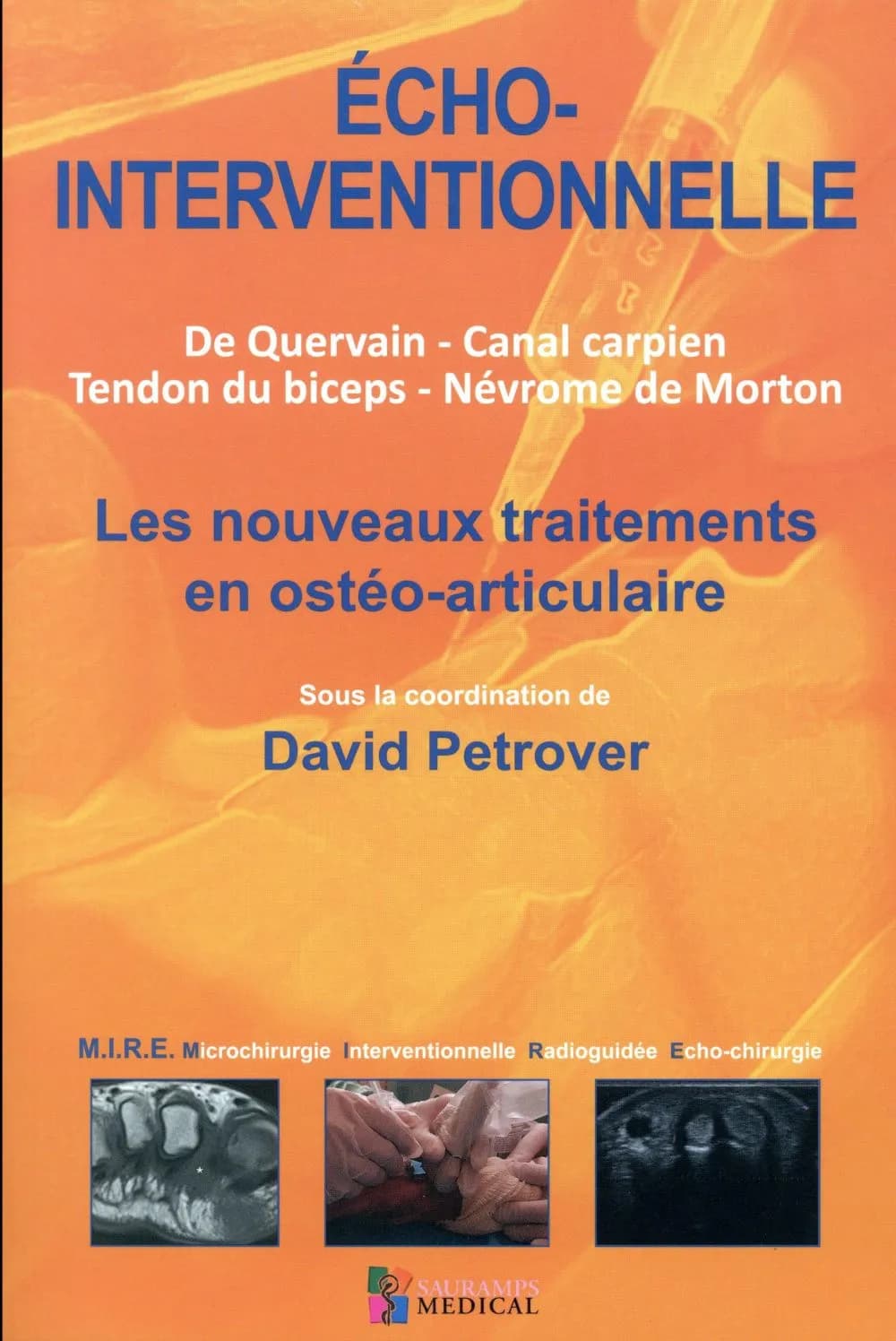 Écho-interventionnelle : de Quervain, canal carpien, tendon du biceps, névrome de Morton : les nouveaux traitements en ostéo-articulaire