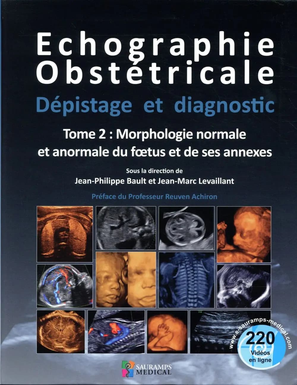 Échographie obstétricale : dépistage et diagnostic. Tome 2, Morphologie normale et anormale du foetus et de ses annexes