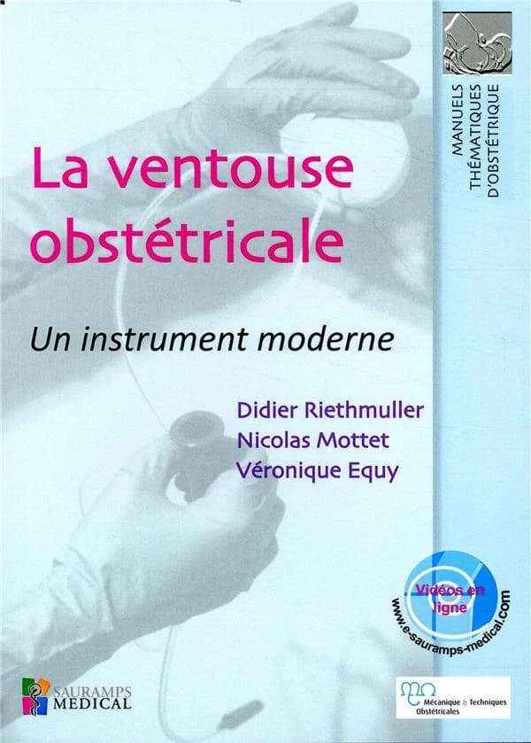 La ventouse obstétricale : un instrument moderne