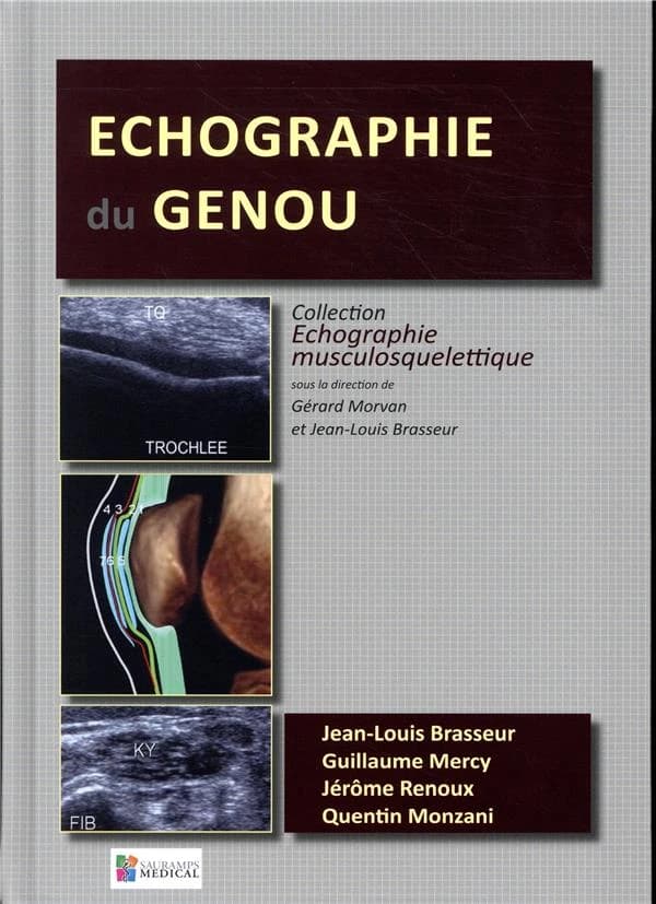 Échographie du genou