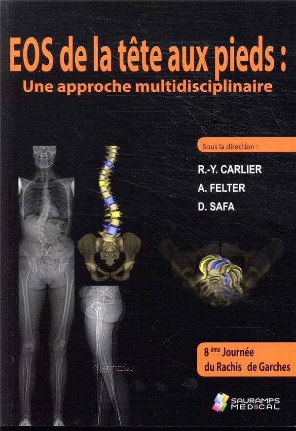 EOS de la tête aux pieds : une approche multidisciplinaire