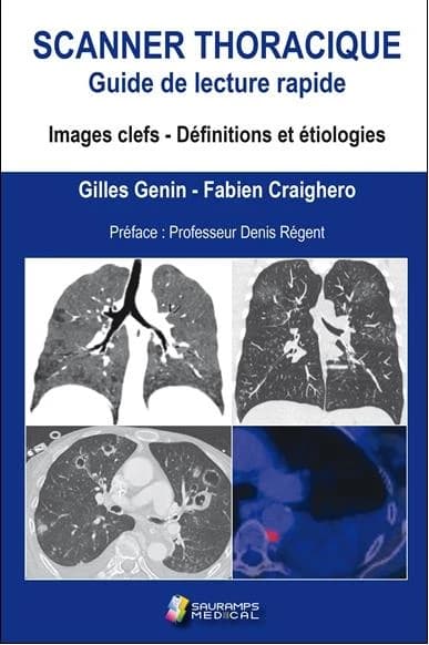 Scanner thoracique : guide de lecture rapide : images clefs, définitions et étiologies