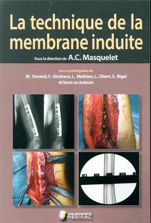 La technique de la membrane induite : principes, pratiques et perspectives