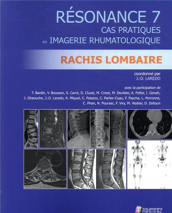 Rachis lombaire