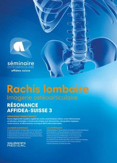 Rachis lombaire : imagerie ostéoarticulaire, confrontation radio-clinique