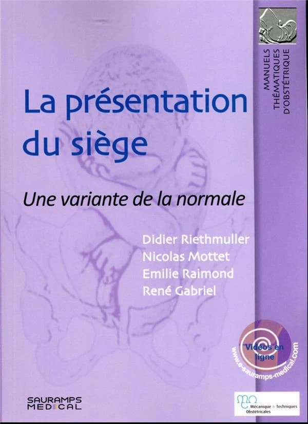 La présentation du siège : une variante de la normale