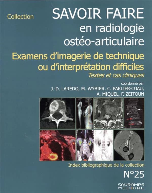 Savoir faire en radiologie ostéo-articulaire. N° 25, Examens d'imagerie de technique ou d'interprétation difficiles : textes et cas cliniques