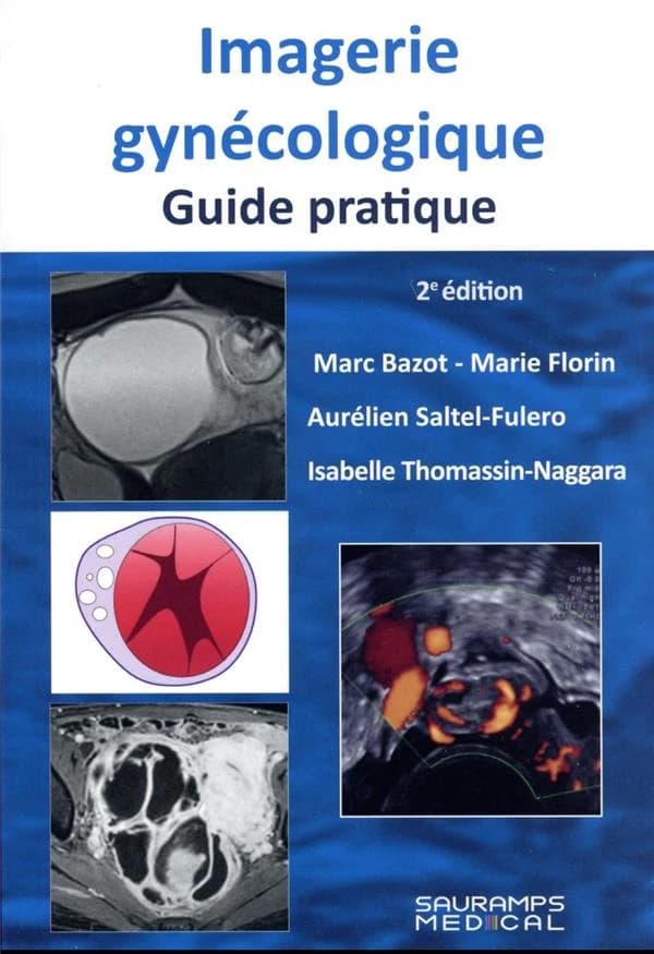 Imagerie gynécologique : guide pratique (2e éd.) Marc Bazot, Marie Florin, Aurélien Saltel-Fulero... [et al.]