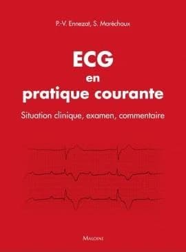ECG en pratique courante : Situation clinique, examen, commentaire