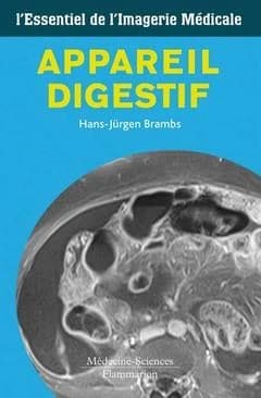 Appareil digestif l'essentiel de l'imagerie médicale