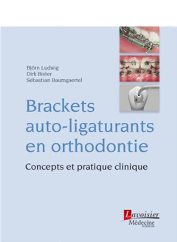 Brackets auto-ligaturants en orthodontie : concepts et pratique clinique