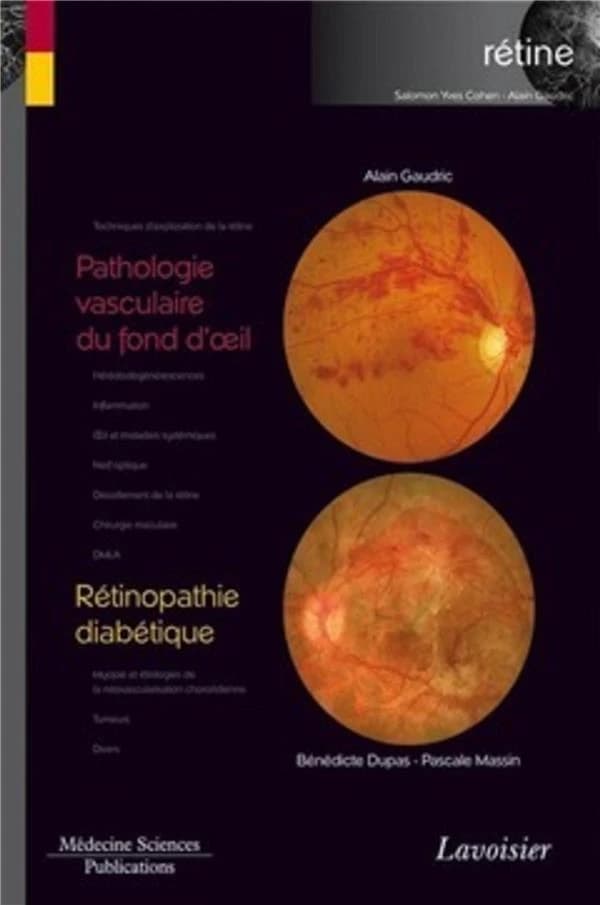 Pathologie vasculaire du fond de l'oeil